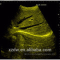 trolley medical ultrasound with 3 transducer ports